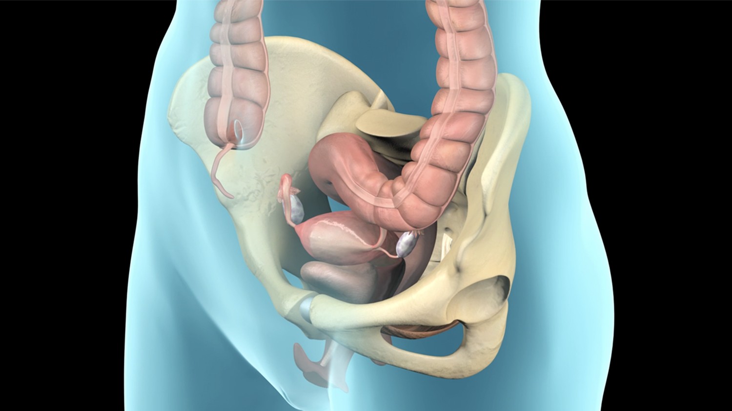 Robotic Pelvic Organ Prolapse Repair